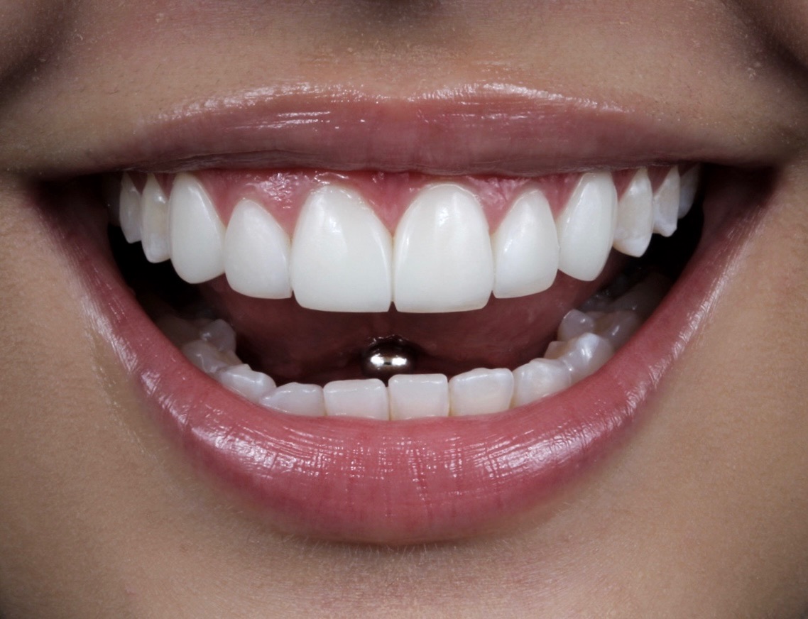 Sonrisa transformada con diseño DSD