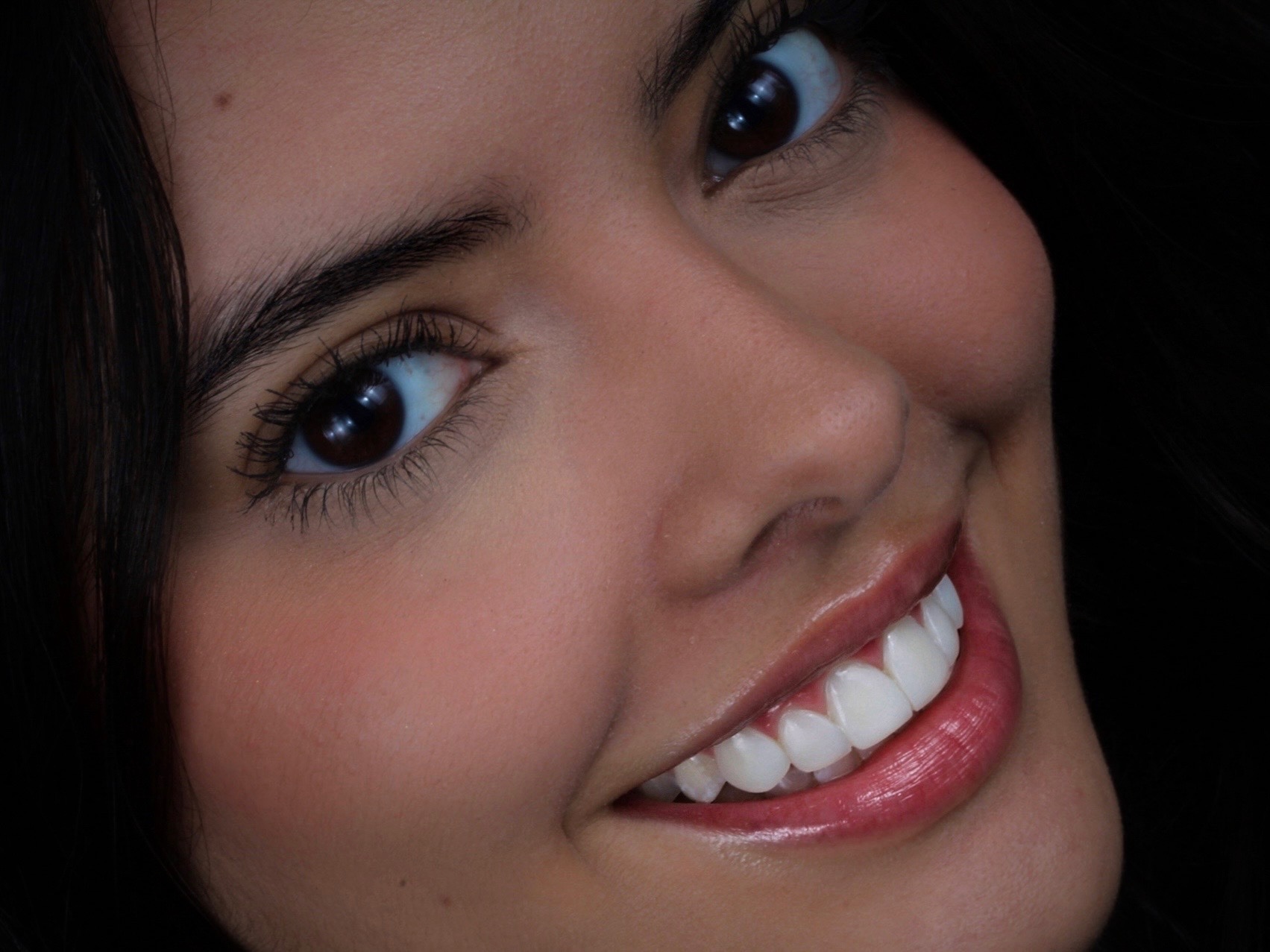 Caso clínico de alta estética dental con DSD — Medellín