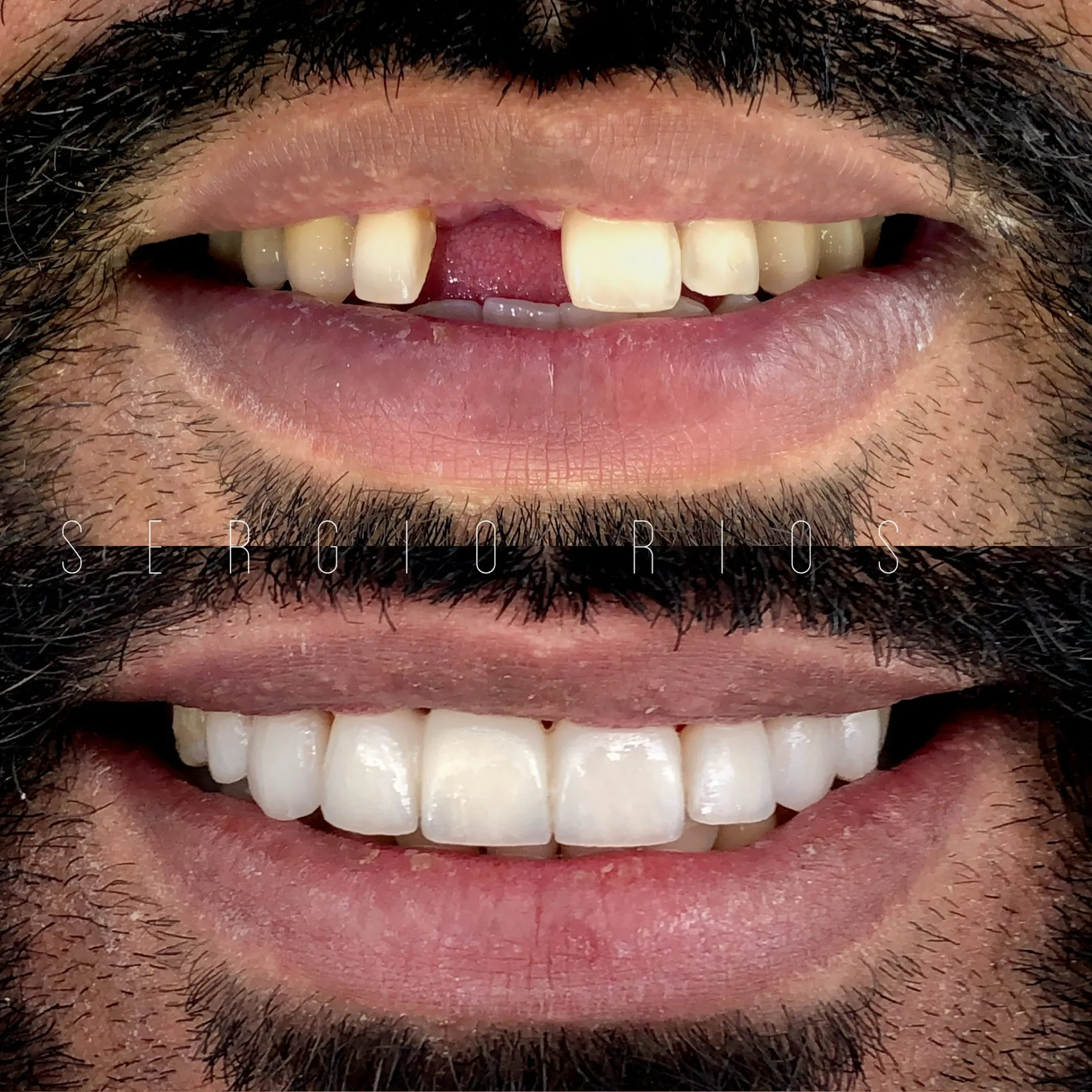 Implantología avanzada — Dr. Sergio Ríos